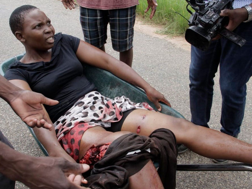 Injuries during protests in Zimbabwe